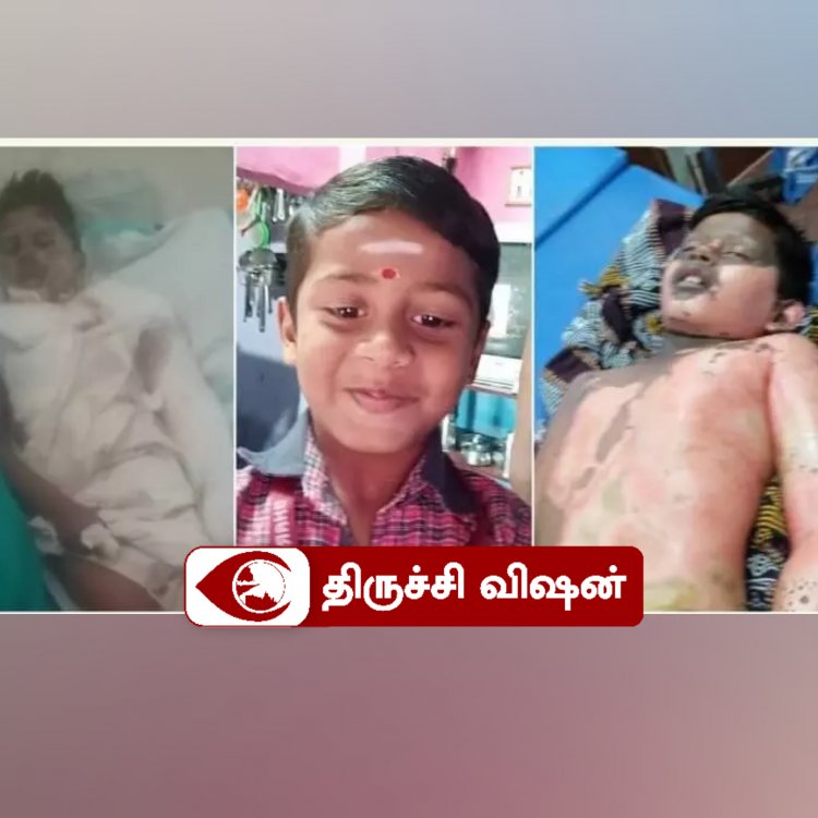 மின்சாரம் தாக்கி காயமடைந்த சிறுவன் - சிகிச்சைக்கு உதவி கேட்கும் பெற்றோர்கள்