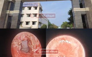 60 வயது நபருக்கு அரிய மூச்சுக் குழல் சுருக்க அறுவை சிகிச்சை: திருச்சி மருத்துவமனையில் வெற்றி!